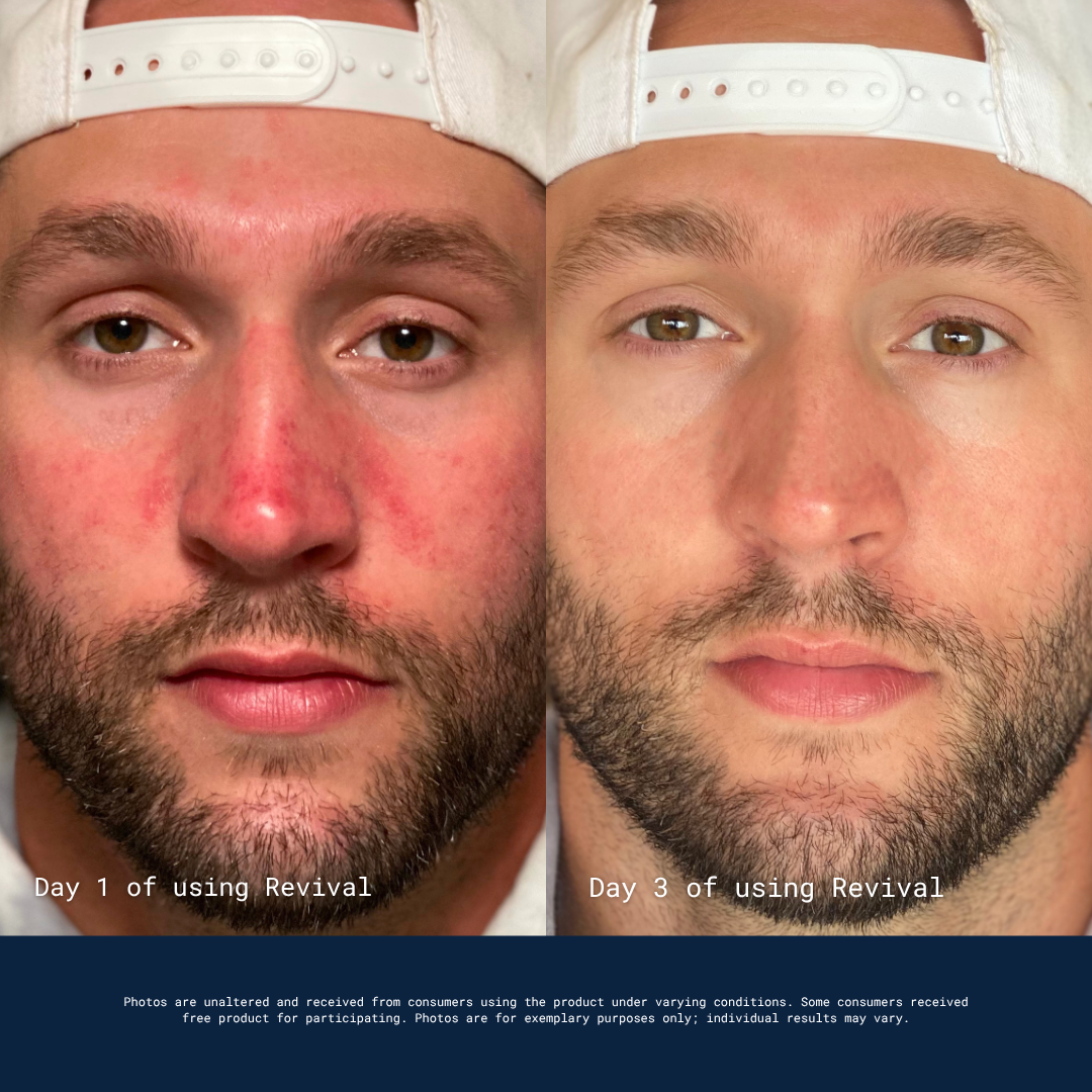 Kevin's own before and after card, day 1 next to day 3 of using Revival.