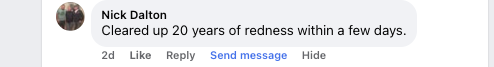 Facebook comment from Nick Dalton: Cleared up 20 years of redness within a few days.
