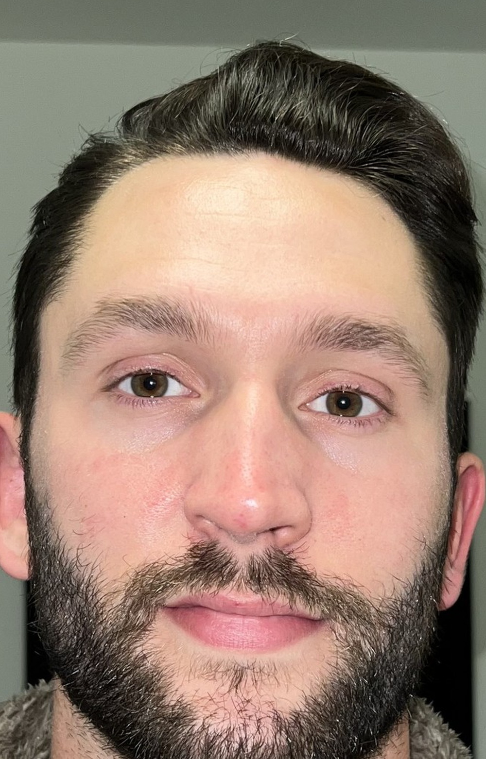 Kevin on day 3 of using Revival, photographed in the same hallway at the same distance.