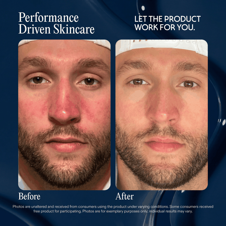 Looping before and after photos from six customers who used Revival for redness.